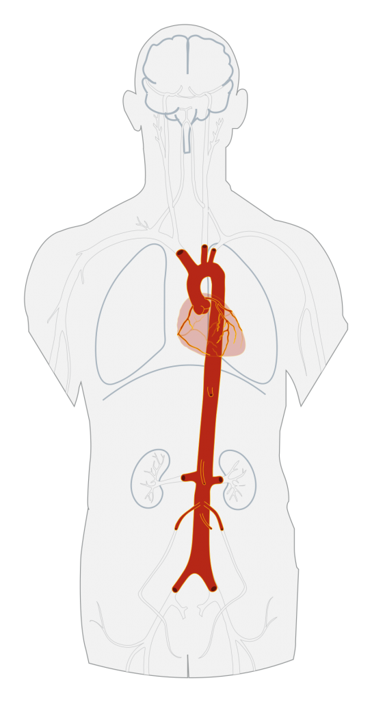 Schematic view of the aorta and a number of its most important branches